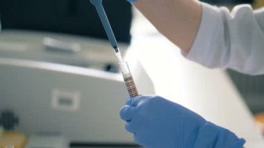 Bir hemşire bir laboratuvar örnekleri ile çalışır.