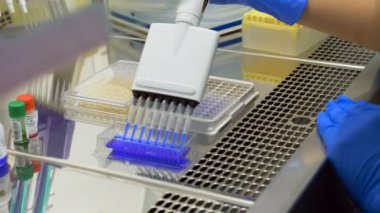 Bir işçi tıbbi pipet örnekleri bir kapsayıcıdan bir laboratuvar, bir tepsi taşıma kullanır.