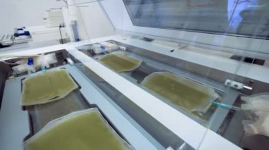 Klinik çalışan bir laboratuvar makine torbalarda plazmada denetler.