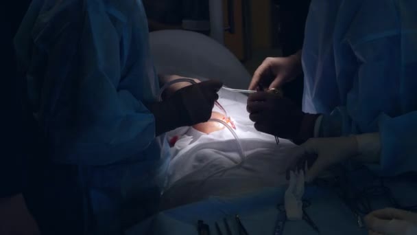 A cirurgia está sendo realizada em um bebê pequeno — Vídeo de Stock