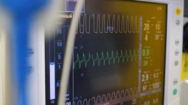 Hayati belirtilerin okunması ile tıbbi ekran