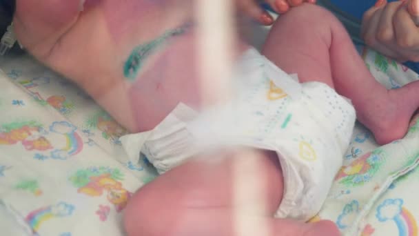 Малыш с дезинфицированными швами лежит в медицинской коробке. — стоковое видео