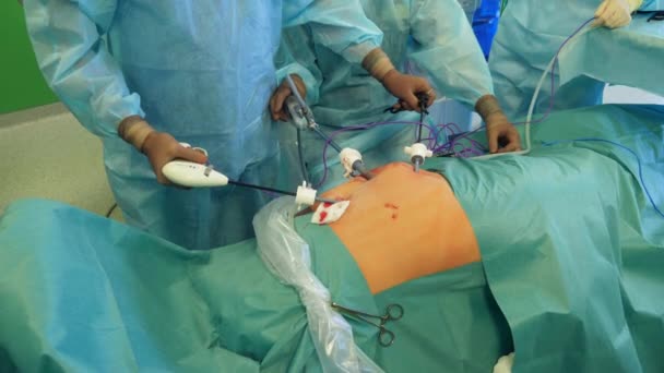 Os médicos estão segurando tubos de metal dentro de um corpo humano — Vídeo de Stock
