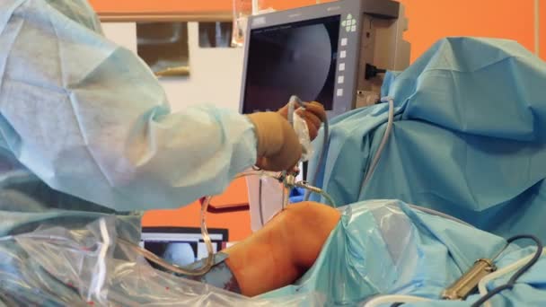 Ludzka noga jest coraz obsługiwana przez chirurga — Wideo stockowe