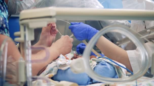 Artsen voeren een medische procedure uit op een baby — Stockvideo