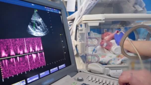 Procedimento de ultra-som realizado em um bebê pequeno — Vídeo de Stock