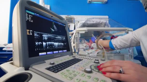 Počítačový displej během ultrazvukového zákroku pro kojence — Stock video