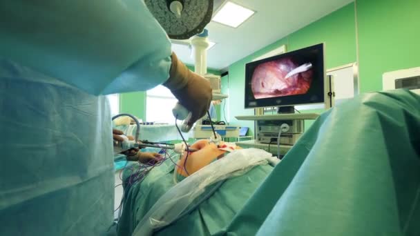 Chirurdzy trzymają operację wyświetlaną na monitorze — Wideo stockowe
