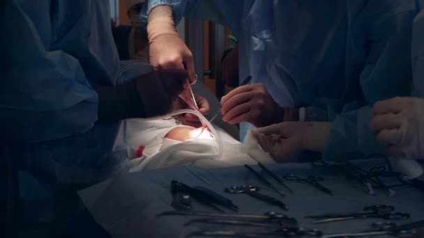 Professionella kirurger utför en operation på en patient med hjälp av verktyg. — Stockvideo