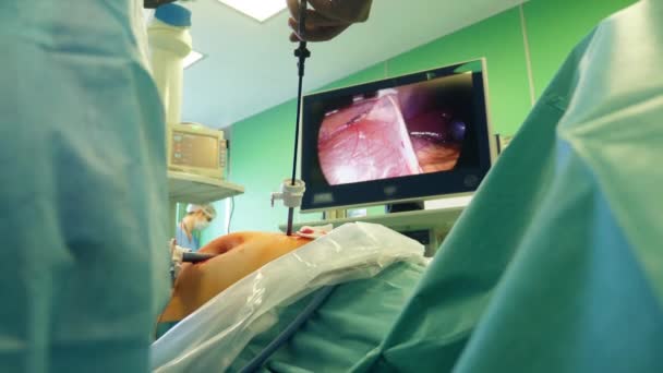 Ablauf der Operation wird auf einem Bildschirm demonstriert — Stockvideo