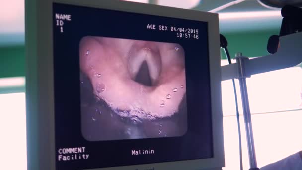 Отображается изображение исследуемого человеческого органа — стоковое видео