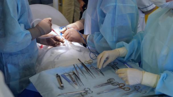 Muitos médicos realizam cirurgia, usando ferramentas médicas limpas . — Vídeo de Stock