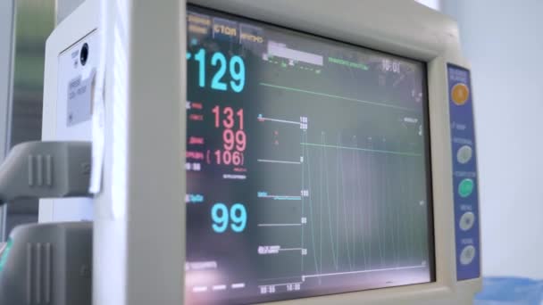 Monitor moderno exibe frequência cardíaca de um paciente durante a cirurgia . — Vídeo de Stock