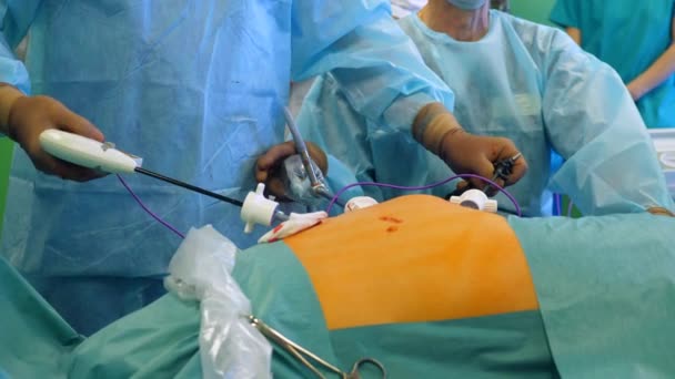 Cirurgiões profissionais usam ferramentas médicas, realizando uma cirurgia em uma clínica . — Vídeo de Stock