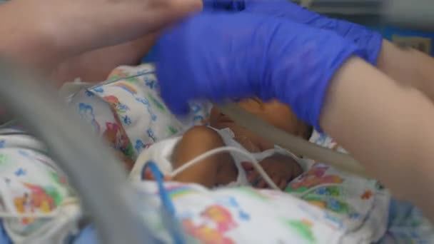 Los trabajadores del hospital trabajan con un recién nacido, conectando tubos . — Vídeo de stock