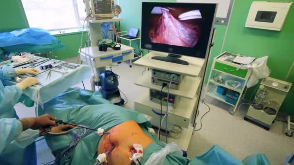 Surgeon uses a tool with camera and looks at a monitor during surgery. — Stock Video