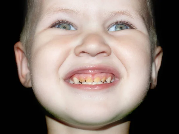 A wide smile of boys demonstrates the wrong oral and dental care.