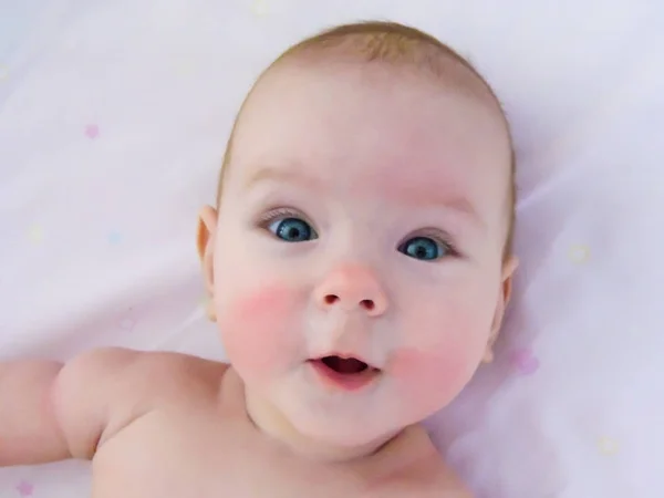 小开朗的女婴宝宝需要日光浴和空气浴 皮肤浸渍 婴儿的脸颊发红 类似于冻伤 — 图库照片