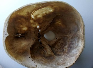 Anatomi çalışması için insan kadın kafatası, üst kesim