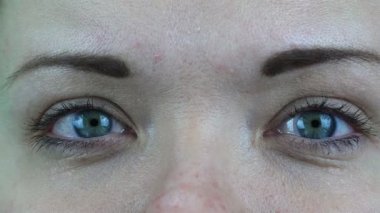 kırık göz kılcal optik lensler dan