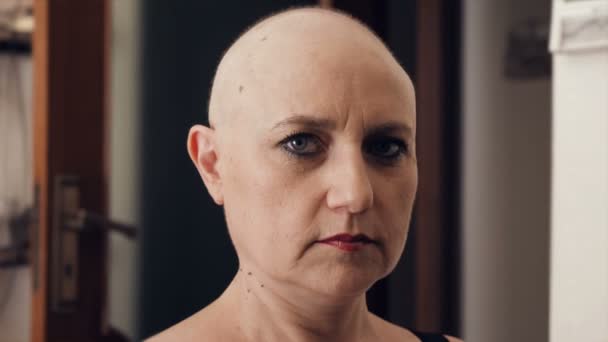 Quimioterapia Enfermedad Retrato Mujer Calva Reflexiva Después Hacer Quimioterapia Mirando — Vídeo de stock