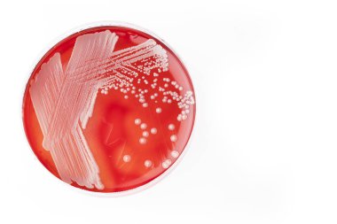 Staphylococcus aureus - bakteri kültürleri. Beyaz arka plan