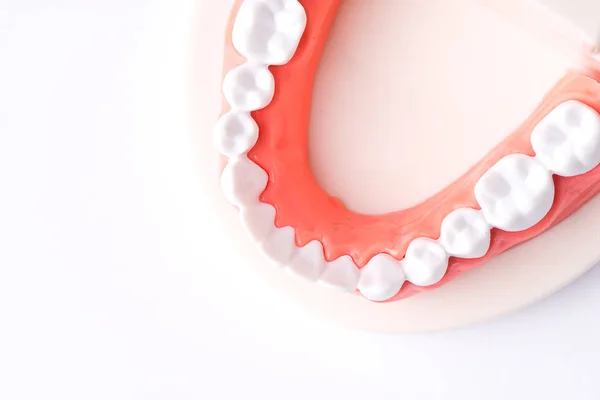 Conjunto Ferramentas Equipamento Dentista Dentadura Mostrando Implante — Fotografia de Stock