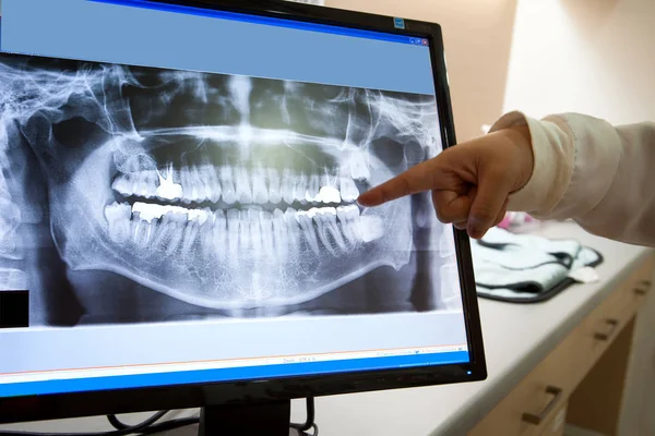 Filme de raios X dental para o conceito de cuidados dentários — Fotografia de Stock