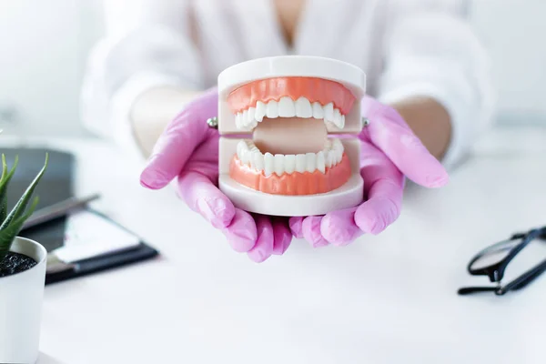 Dentista Sosteniendo Modelo Prótesis Dentales Consultorio Del Dentista Médico Demostrar —  Fotos de Stock