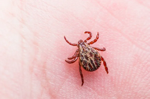脑炎病毒或莱姆病感染皮肤的尖锐湿疣昆虫 — 图库照片