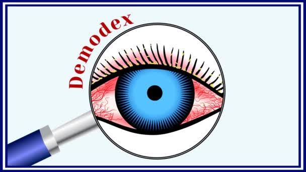 Demodex Parasitic Eye Disease Animation — Stock Video