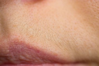 küçük kıllar dudaklar yukarıda. kadın sorunları