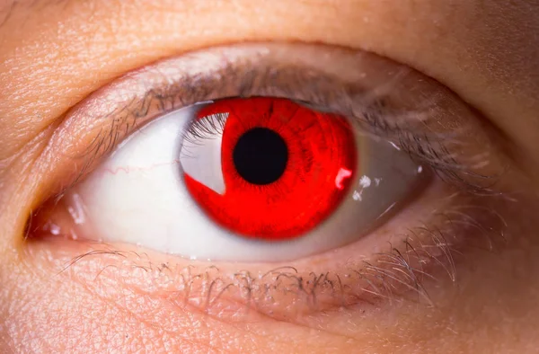 Occhio Sangue Rosso Vicino — Foto Stock