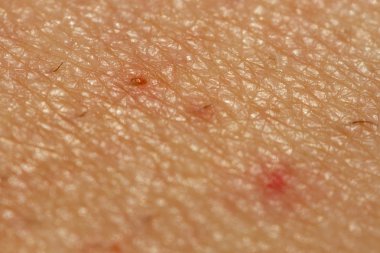 Bir yaranın aşırı yakın çekim görünümü