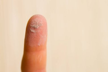 Parmağında toz