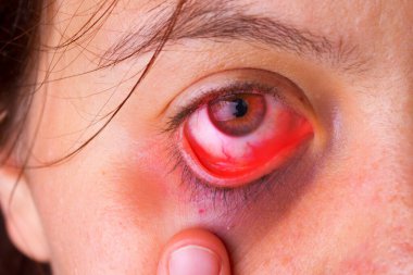 Bilgisayarda çalıştıktan sonra sinirlendirme