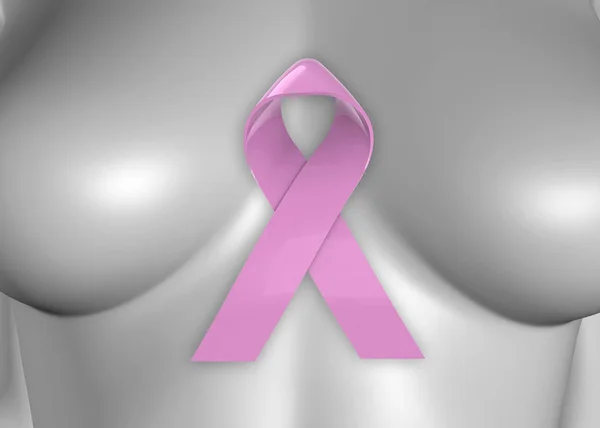 Breast Cancer - 3D Concept — Stock Photo, Image