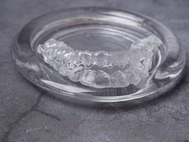 Diş aligners. Görünmez parantez içinde cam Parlatıcı kavramı gülümse