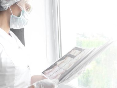 Hastanede bir hastanın röntgenini izleyen tıbbi doktor, tomografi analizi.