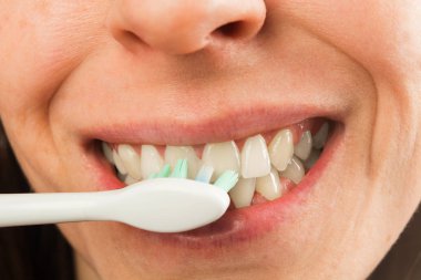 Elektrikli diş fırçası, seçici odak olan dişi beyaz sağlıklı diş görünümünü kapat