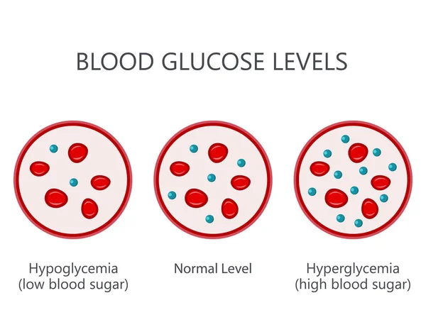 Blood Glucose Sugar Levels — Stock Vector