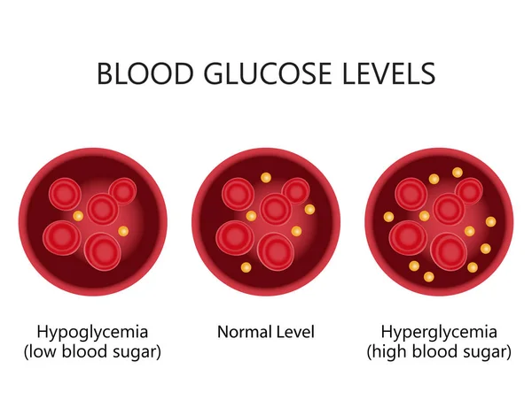 Niveles de glucosa en sangre . — Archivo Imágenes Vectoriales