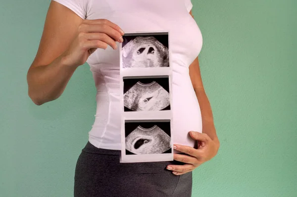 The girl is holding a snapshot of an ultrasound twin in the fourth week of pregnancy. First trimester. Confirmation of pregnancy.