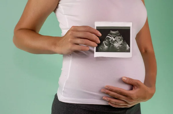 The girl is holding a snapshot of an ultrasound twin in the fourth week of pregnancy. First trimester. Confirmation of pregnancy.