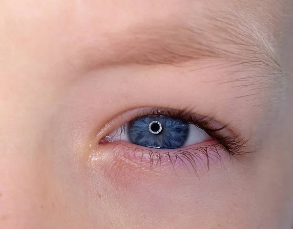 One eye of a teenager macro close-up — Stock Photo, Image