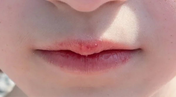 Lips natural close-up teen girl front view — Stok Foto