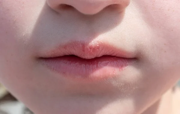 嘴唇 自然 特写 青少年 女孩 前视图 — 图库照片