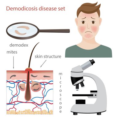 demodex-01