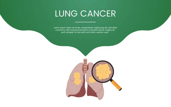 Tema de conceito de câncer de pulmão para banner de modelo ou infográficos de página inicial de destino - vetor —  Vetores de Stock