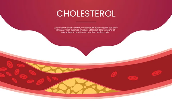 Concepto de vena humana colesterol tema para banner plantilla o landing página de inicio infografías - vector — Archivo Imágenes Vectoriales